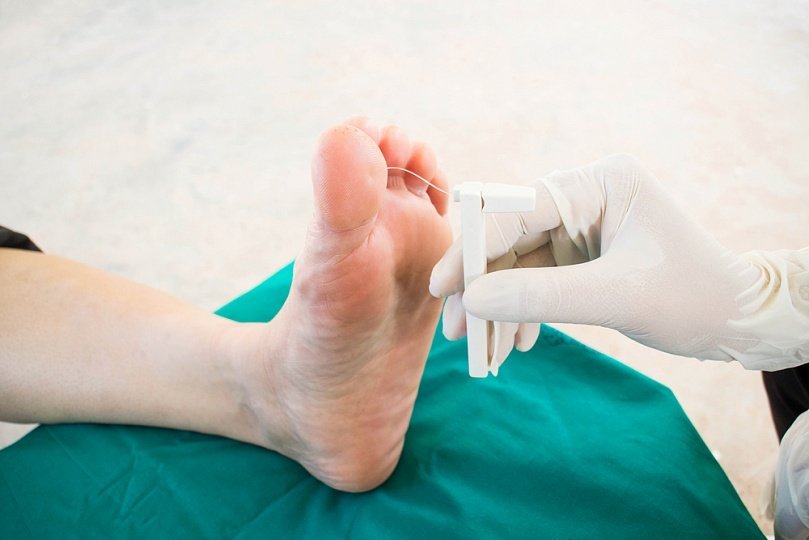 Атеросклероз сосудов ног: симптомы и лечение
